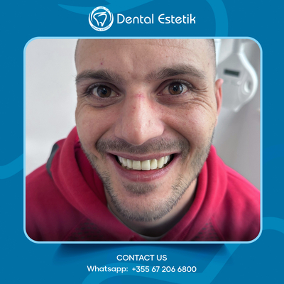 Slider image (1) Dental Estetik - Dental Clinic in Tirana, Albania